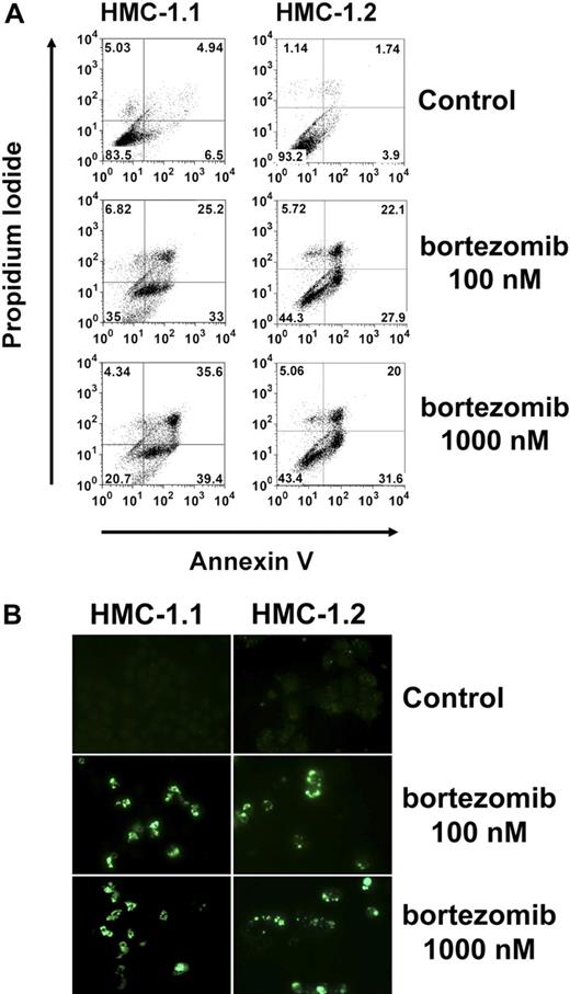 Figure 5. Flow cytometric determination of apoptosis by combined annexin V/propidium iodide and by TUNEL assay. (A) HMC-1.1 cells (left panel) and HMC-1.2 cells (right panel) were exposed to bortezomib (100nM, middle panel; 1μM, right panel) or control medium (top panel) at 37°C for 24 hours. Thereafter, cells were washed and incubated with annexin V–fluorescein isothiocyanate. Then, propidium iodide was added. Cells were then washed and analyzed by flow cytometry. (B) Determination of apoptosis by TUNEL assay. HMC-1.1 cells (left panel) and HMC-1.2 cells (right panel) were exposed to bortezomib (100nM, middle panel; 1μM, right panel) or control medium (top panel) at 37°C for 24 hours. Thereafter, a TUNEL assay was performed as described in “Methods.” Cells were analyzed on a Nikon Eclipse E 800 fluorescence microscope (Nikon) equipped with 100×/1.35 UPlan-Apo objective lens (Olympus). Figure acquisition was performed using Olympus DP11 camera and Adobe Photoshop CS2 software Version 9.0 (Adobe Systems). Magnification, ×400.