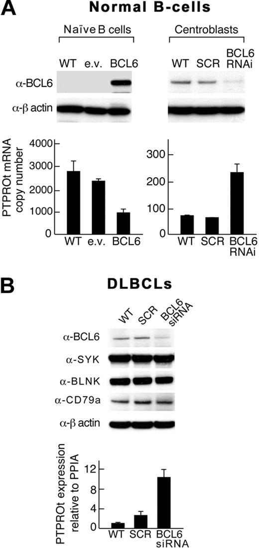 Figure 4. BCL6 regulates PTPROt expression in normal naive B cells, GC centroblasts, and certain DLBCLs. (A) Normal B cells. Normal naive B cells (left) were transfected with a eGFP-BCL6 construct or empty vector and GC centroblasts (right) were transduced with a BCL6-shRNA lentiviral vector or scrambled control. (B) DLBCLs. A DLBCL cell line (DHL4) was transduced with BCL6 siRNA. In both the normal B cells (A) and the DLBCL cell line (B), BCL6 protein levels were assessed by Western blot (top panel), and PTPROt expression was evaluated by RT PCR (bottom panel). In DLBCLs, expression levels of total SYK, the upstream BCR pathway component, CD79a, and the downstream adapter protein, BLNK, were also evaluated. Error bars represent SDs from the mean for 3 independent RT-PCR assays for each condition and cell type in a representative experiment.