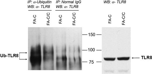 Figure 1. TLR8-ubiquitin coimmunoprecipitation. Immunoprecipitations were performed by the use of antiubiquitin antibodies (lanes 1-2) or nonspecific control immunoglobulin (lanes 3-4), and immunoblots of the precipitated material were performed by the use of anti-TLR8 antibodies (left). A greater amount of ubiquitinylated TLR8 was detected in immunoprecipitates of mutant cells, confirming the proteomics result. The distinct upper band (lane 1 vs lanes 3-4) is consistent with monoubiquitinylation (8.5 kDa). Total TLR8 protein levels in whole cell lysates were identical in mutant and complemented cells (right). The data shown are representative of 3 identical experiments. A second experiment with loading controls and nonspecific immunoglobulin controls is shown in supplemental Figure 1.