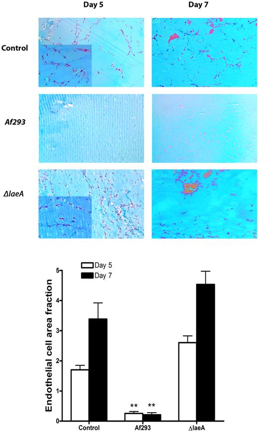 Figure 2. In vivo Matrigel assay of angiogenesis in A fumigatus-infected and uninfected control mice. The antiangiogenic effects of A fumigatus in mice with cutaneous invasive aspergillosis were assessed using an in vivo Matrigel assay. In uninfected control mice, endothelial cell migration and capillary network formation occurred 5 days after implantation of the Matrigel; 7 days after implantation, erythrocyte-filled lacunae formed in the Matrigel. In contrast, angiogenesis was significantly suppressed in Matrigel plugs extracted from A fumigatus-infected mice 5 and 7 days after inoculation. Plugs obtained from ΔlaeA-infected mice exhibited endothelial cell infiltration similar to that of plugs obtained from uninfected control mice. Insets show enhanced details of endothelial networks. **P < .001. P values refer to the comparison with Matrigel plugs obtained from uninfected control mice and plugs from ΔlaeA-infected mice.