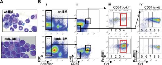 Figure 2. Identification of the population of cells accumulating in leukemic bone marrow of MRP8 hPML-RARα mice. (A) Cytospins of single-cell suspensions of total bone marrow from wild-type (top) and leukemic mice (bottom) after ACK treatment stained with Wright-Giemsa (original magnification ×63). The leukemia developed after transplantation with 2.5 × 105 to 5 × 106 cells from total leukemic spleen of a MRP8 hPML-RARα mouse. Mice were killed and analyzed when moribund. (B) Phenotypic analysis of leukemic cells (bottom panel) isolated from bone marrow display an increase of immature cells (CD34+/c-kit+ fraction) and accumulation of cells in subpopulations 3 and 4 that reflects the block at promyelocytic stage of differentiation (red rectangle) together with a decrease of more mature cells (subpopulations 5-9) compared with wild-type bone marrow (top panel). Negatively selected cells (Bi) from bone marrow were separated into CD34+/c-kit+ and CD34−/c-kit− fractions (Bii). CD34/c-kit double-positive cells were further fractionated into 4 fractions (subpopulations 1-4) according to Gr1 levels (Biii), and CD34/c-kit double-negative cells were further fractionated into 5 fractions according to Gr1 levels (subpopulations 5-9; Biv).