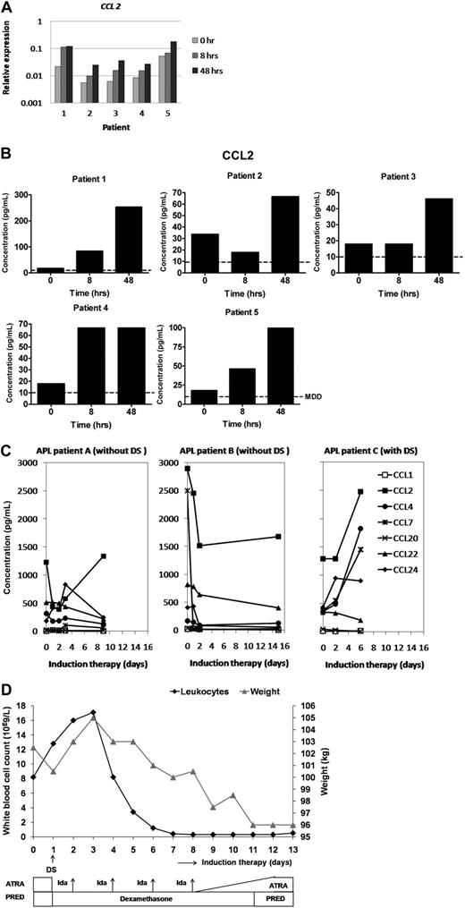 Figure 3. ATRA induces CCL expression in APL patients in vitro and in vivo. (A) Primary leukemia cells derived from 5 different APL patients at diagnosis were cultured with ATRA (10−6 M) for 0, 8, and 48 hours CCL mRNA expression was determined at the indicated time points by quantitative PCR. Expression relative to GAPDH is plotted. (B) CCL2 protein levels were determined in supernatant of the leukemic cells at the indicated time points using ELISA. (C) Protein levels of CCLs were determined in plasma of 3 APL patients before and during induction therapy with ATRA (45 mg/m2 per day), idarubicin (Ida, 12 mg/m2 per day on days 2, 4, 6, and 8), and prednisone (PRED, 0.5 mg/kg per day) using ELISA. Patient A (left panel) and patient B (middle panel) had no signs of DS. Patient C (right panel) developed a DS within 24 hours after initiation of induction therapy. (D) Clinical course of APL patient C who developed DS. The patient presented with a high WBC count (8.2 × 109/L). One day after onset of induction therapy, DS manifested with mild respiratory distress, pleural effusion, and diffuse pulmonary infiltrates on chest X-ray. ATRA was discontinued and dexamethasone (10 mg/12 hours) was administered. A peak WBC count of 17.1 × 109/L (black line) was reached 3 days after start of therapy. Although ATRA therapy was discontinued, the patient developed generalized edema, weight gain (gray line), and headache. Respiratory distress aggravated on days 4 to 5, resulting in an increasing need for oxygen supply. High resolution computed tomography on day 6 showed evident signs of interstitial and alveolar pulmonary edema. After DS completely resolved, ATRA was resumed on day 8 at a 20% dose and gradually increased to a 100% dose at day 12. Dexamethasone was continued until day 11.
