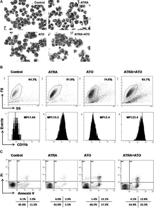 Figure 4. Induction of differentiation and apoptosis by ATRA and ATO in NB4 cells. NB4 cells were cultured in medium in the presence or absence of ATRA (10−6 M), ATO (10−6 M), or their combination, for 0, 4, 8, 24, 48, 72, and 96 hours. (A) May-Grünwald-Giemsa staining was performed on cytospins after the indicated treatments for 96 hours. ATRA-treated cells showed typical differentiation features, such as wider cytoplasm and more lobulated nuclei. ATO-treated cells showed evident signs of apoptosis, including fragmentation of the nuclei and formation of apoptotic bodies. Original magnification ×400. (B) After 72 hours of ATRA and/or ATO treatment, CD11b expression was analyzed by flow cytometry to determine differentiation. Mean fluorescence intensity (MFI) of the life-gated cells is plotted. (C) Annexin V and propidium iodide (PI) staining was performed to determine apoptosis after 72 hours of ATRA and/or ATO treatment. Analysis was performed on the ungated cells. The percentages of negative, single-positive, and double-positive cells are depicted.