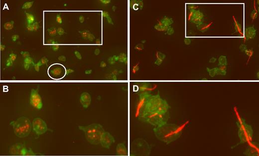 Figure 1. Confocal analysis of CD41 and VWF localization. (A) Fixed platelets from hTgWT animals were allowed to adhere to glass coverslips and subjected to immunofluorescent staining. Maximum intensity projections of a deconvolved image stack were obtained using confocal microscopy. The raw confocal stack images were deconvolved with iterations limited to 10 using Huygens Essential Software. The presented image is a color merge of VWF (red) and CD41 (green) in hTgWT platelets. VWF staining was obtained with a rabbit polyclonal anti–human VWF antibody and an anti–rabbit CY3 secondary antibody. The hTgWT platelet surface was labeled using a rat anti–mouse CD41 antibody and an anti–rat Alexa488 secondary antibody. The circled platelet was further analyzed and is presented as a surface rendered image in Figure 2. (B) A higher magnification of the boxed region is shown for clarification. VWF labeling is restricted to platelet granules. (C) As described for panel A, wide-field microscopy of platelets from mice expressing a G233V GP Ibα subunit (hTgG233V) is shown. (D) A higher magnification of an isolated region is shown for clarification.