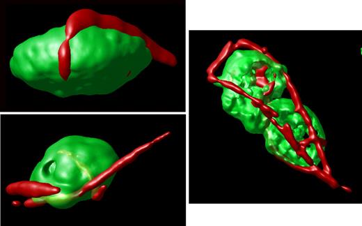 Figure 3. Surface-rendered projections. Representative platelets from an hTgG233V animal are shown. Surface-rendered fluorescence for CD41 antigen (green) and VWF fluorescence (red) reveals the linear surface adhesion of VWF on the platelet surface from animals expressing a PT-VWD mutation. The example shown to the right highlights the linear nature of the bound VWF and the ability of VWF to bridge platelets and support micro-aggregate formation. Additional images are available online (see the supplemental Figures).