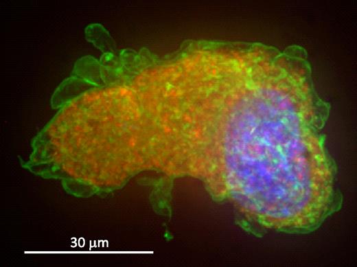Figure 4. Confocal-stacked image of a bone marrow megakaryocyte. hTgG233V megakaryocytes were analyzed and show a typical granular distribution of VWF in the cytoplasm. Percoll-gradient megakaryocytes were fixed and labeled for VWF, CD41, and 4,6-diamidino-2-phenylindole. Maximum-intensity projection of the deconvolved image stack was obtained using a spinning-disk confocal microscope. Deconvolution was performed to get a sharper picture. A composite of VWF in red, CD41 in green, and nuclear staining in blue is shown. VWF is visualized as part of the megakaryocyte granule content, as opposed to CD41, which is most visible on the surface of the platelet precursor. No surface-bound VWF was observed.