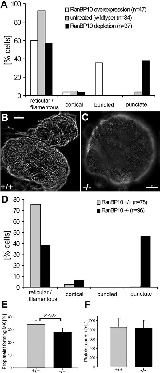 Figure 3. Punctuated MT filaments in RanBP10−/− MKs. For the quantitative evaluation of MK immunostained with an antibody against β-tubulin, 4 different MT network classifications were determined: reticular, cortical, bundled, and punctuated. The percentage of each subtype was determined individually. (A) The comparison of RanBP10-depleted, RanBP-overexpressing, and wild-type MKs indicated diverging effects on MT bundling and filament collapse. (B-C) Representative examples of immunostained MKs with reticular filamentous MT (B) and punctuated MT (C); scale bar 10 μm. (D) RanBP10-null MKs show a lack in filamentous MTs compared with wild-type cells but an increase in punctuated MT. (E) MK cultures were examined for proplatelet formation by light microscopy on day 5 of cultivation with TPO. RanBP10-null MKs have a slight decrease in proplatelet formation that is statistically significant (P < .05). Error bars represent SD. (F) Peripheral platelet counts did not differ between wild-type and mutant animals.