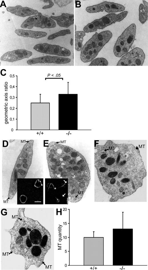 Figure 4. Loss of RanBP10 results in a disordered platelet marginal band. Platelets were obtained from adult mice by retro-orbital blood withdrawal, fixed, and subsequently analyzed by transmission electron microscopy. (A) The overview of wild-type platelets showed the typical discoid shape of platelets with normal granular content. (B) RanBP10−/− platelets exhibit no differences in granular content but a less discoid shape. (C) The change of the platelet shape was quantified by determination of the geometric axis ratio, which shows a statistical significant increase (P < .05; t test) between wild-type (n = 21) and RanBP10-null mice (n = 25). (D) Wild-type platelets possess a normal amount8–12 of MT coils (MT, black arrows) in the periphery. (E) In contrast some RanBP10-deficient platelets exhibit a greater amount (here up to 25) of filaments per coil coils (MT, black arrows). (F) Other platelets showed a normal number of MT filaments per coil, but an atypical appearance in profile (black arrow) and axis (black arrowhead) in one cross-section. (G) RanBP10-knockout platelets also showed additional MT coils (MT, black arrow). Immunofluorescence analysis was consistent with electron microscopy regarding the marginal band. (D) Inset shows wild-type platelets immunostained with an antibody against β-tubulin, with typical MT coils, representing the marginal band. (E) Inset shows the disordered marginal band of RanBP10−/− platelets by immunofluorescence microscopy. Despite having a normal marginal band (not shown), the platelets exhibit multiple starting points of MT coils (white asterisk) and structures that look like halved MT coils (white arrows). (H) Quantification of filaments per MT coil in wild-type (n = 17) and RanBP10 knockout platelets (n = 15) shows a small increase of MT coils for the RanBP10-deficient platelet, but the high standard deviation indicates that the number of MT coils ranges from well above to well below normal. Original magnification, ×10 000 (A-B); ×∼ 35 000 (D-G). Scale bars (insets D-E) indicate 2 μm. The resolved images and quantifications are representatives of 2 independent experiments.
