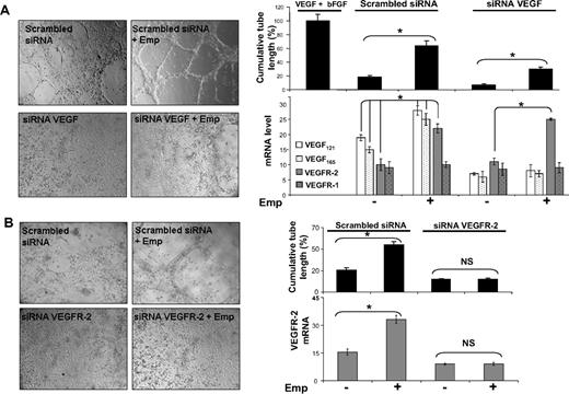 Figure 3. EMMPRIN induces capillary-like structure formation by endothelial cells via VEGF and VEGFR-2. HMEC-1 transfected with VEGF, VEGFR-2 siRNA, or scrambled siRNA were seeded on top of a fibrin gel and treated with Emp for 24 hours in serum-free medium. (A) Capillary-like structure formation by HMEC-1 cells transfected with siRNA-targeting common sequence of VEGF isoforms. A mix of VEGF and bFGF and serum-free medium was used as positive and negative controls, respectively. VEGF121, VEGF165,VEGF189, VEGFR-1, and VEGFR-2 transcript quantification by qRT-PCR. (B) Capillary-like structure formation by HMEC-1 cells transfected with VEGFR-2 siRNA. VEGFR-2 transcript quantification by qRT-PCR. Results are presented as the mean of 3 independent experiments and expressed as a percentage of the cumulative tube length obtained for the positive control set at 100%. Columns indicate means of relative expression to TBP housekeeping gene of 3 independent experiments; and bars, SD. *P < .05.
