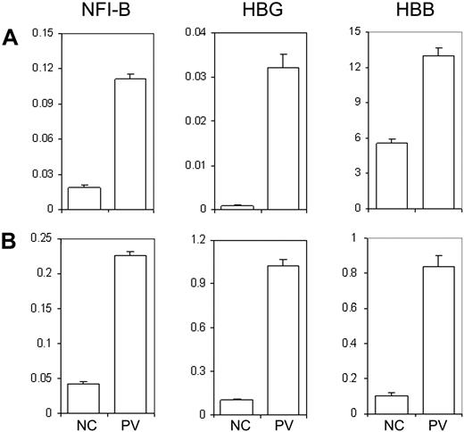 Figure 5. Human iPS generated hematopoietic progenitor cells exhibit unique gene expression pattern similar to the primary CD34+ cells from the PV patient and a normal control. (A) Total RNA was isolated from primary CD34+ cells from a healthy donor as an NC or from the PV patient (MPD183) where the PV-iPS cell lines were derived from. Gene expression of NFI-B, HBG, and HBB as well as β-actin (as a control) was analyzed by real-time quantitative PCR after reverse transcription of RNA. The normalized level (relative to that of β-actin) is plotted. (B) An identical analysis of purified CD34+CD45+ cells generated from PV iPS (iMPD183) cells and NC iPS cells derived from normal adult CD34+ cells. Data are presented as mean ± SD (n = 2).