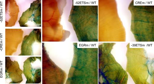 Figure 5. LacZ staining of diaphragm from Hprt-targeted mice carrying wild-type or mutant VEGFR1 promoters. Diaphragms were harvested from 6- to 8-week-old F2 male Hprt-targeted mice carrying wild-type (WT) or mutant VEGFR1-lacZ transgenes and processed in parallel for whole-mount staining with X-Gal. In each panel, the diaphragm from WT VEGFR1 transgenic is on the right, and the diaphragm from the mutant mouse is on the left. The exposure time in bottom right panel was reduced compared with other panels. Whole-mount diaphragms were analyzed under a Nikon SMZ-U dissecting microscope, and microphotographs were collected using a Nikon Coolpix 8400 camera.