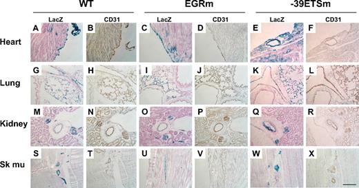 Figure 6. LacZ staining of tissue sections. Cryosections were collected from heart, lung, kidney, and skeletal muscle (Sk mu) harvested from 6- to 8-week-old F2 male Hprt-targeted mice carrying wild-type, −39 ETSm, or EGRm VEGFR1 transgenes and stained with X-Gal. Serial sections were processed for CD31 immunohistochemistry. Images were obtained using a 20× objective. Bar, 100μM. Lac-Z-stained sections were counterstained with eosin. Slides were analyzed under a Zeiss Axio Imager upright microscope, and photomicrographs were collected using a Zeiss Axiocam MRc camera and Axiovision 4.6.3 image acquisition software.