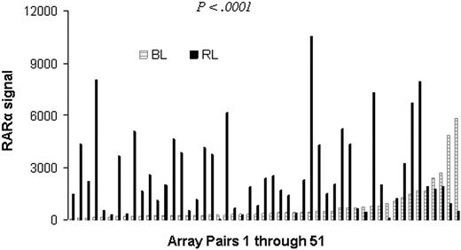 Figure 1. Increased RARα expression in relapsed MM. Paired CD138+ MM cell samples were obtained at diagnosis and relapse from 51 patients diagnosed with MM. Gene expression profiling analysis were performed on these samples. Shown is the RARα signal at diagnosis (BL) and relapse (RL). Note that RARα expression is significantly increased at relapse compared with this at diagnosis (paired t test, P < .001).