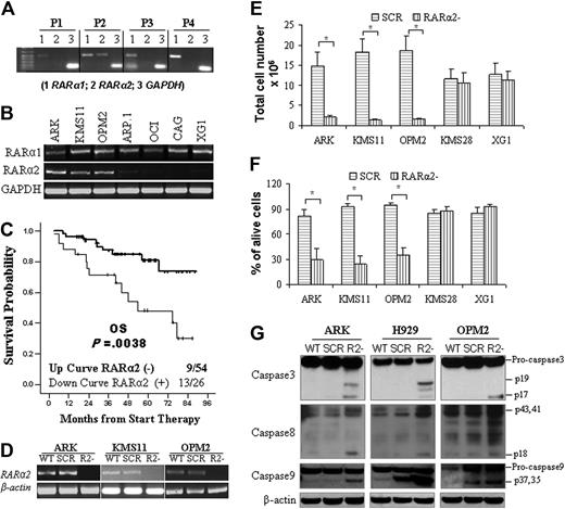 Figure 2. RARα2 expression is associated with poor prognosis in MM. RT-PCR detected the expression of RARα1, RARα2, and GAPDH in MM cells from patients (P1-P4; A) and MM cell lines (B). Representative results are shown. (C) Kaplan-Meier analysis of OS of patients newly diagnosed with RARα2+ (n = 26) and RARα2− (n = 54) MM in TT2 and TT3 trials. (D) RT-PCR was used to examine RARα2 expression in RARα2 knockdown MM cells (R2−). Wild-type (WT) and nontargeting scramble shRNA (SCR)–transfected cells were used as controls; RARα2 knockdown MM cells were cultured for 4 days, live cells were counted to calculate cell proliferation (E), and dead cells were determined by positive trypan blue staining, from which the dead-cell fraction was calculated (F). Results are expressed as means plus or minus SD of 3 independent experiments. *P < .05. (G) Western blot analysis of caspase-3, caspase-8, and caspase-9 (cleaved and uncleaved proteins) in WT, SCR, and R2− cells of ARK, KMS11, and OPM2 MM cells. Cells were collected at day 3 in the cultures. β-actin was used as loading control. Shown are the representative results of 3 independent experiments.