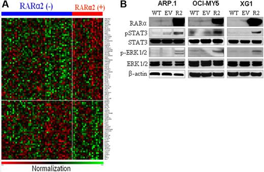 Figure 3. Identification of RARα2-associated signals. (A) Heat maps of the 96 differentially expressed genes in RARα2− (n = 54) and RARα2+ (n = 26) MM cell samples from the 80 patients. Gene symbols are plotted at the right side, and samples are plotted along the top horizontal axis. Red indicates up-regulation; and blue indicates down-regulation. (B) Western blots examined pSTAT3 and STAT3 and p-RK and ERK in RARα2-overexpressing (R2) cells of ARP.1, OCI-MY5, and XG1 cells. Wild-type (WT) and EV cells were used as controls. β-actin was used as loading control. Shown are the representative results of 3 independent experiments.