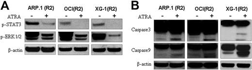 Figure 5. Identification of ATRA-induced signals in RARα2+ MM cells. (A) Western blots examined pSTAT3 and pERK1/2 in RARα2 (R2)–overexpressing ARP.1, OCI-MY5 (OCI), and XG-1 cells with (+) or without (−) ATRA treatment. (B) Western blot analysis of caspase-3 and caspase-9 in R2-overexpressing ARP.1, OCI, and XG-1 cells with (+) or without (−) ATRA treatment. β-actin was used as loading control. Shown are the representative results of 3 independent experiments.