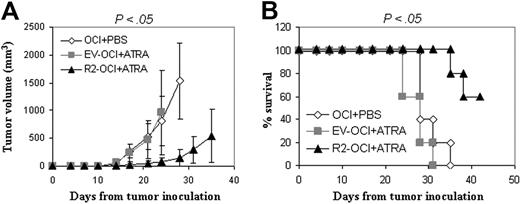 Figure 6. Efficacy of ATRA in treating the RARα2-overexpressing MM tumors in SCID mice. Mice (n = 5 in each group) were challenged with 2 × 106 OCI-MY5 (OCI), EV, or RARα2 (R2)–transfected cells. At 10 days following tumor inoculation, ATRA treatment was given to EV-transfected (EV-OCI + ATRA) and R2-transfected (R2-OCI + ATRA) MM tumors 3 times per week for 3 weeks; OCI tumors receiving PBS (OCI + PBS) were used as controls. (A) Tumor volumes of mice following tumor injection. Results are expressed as means plus SD. (B) Survival curve of mice following tumor injection. Shown are the representative results of 2 independent experiments.