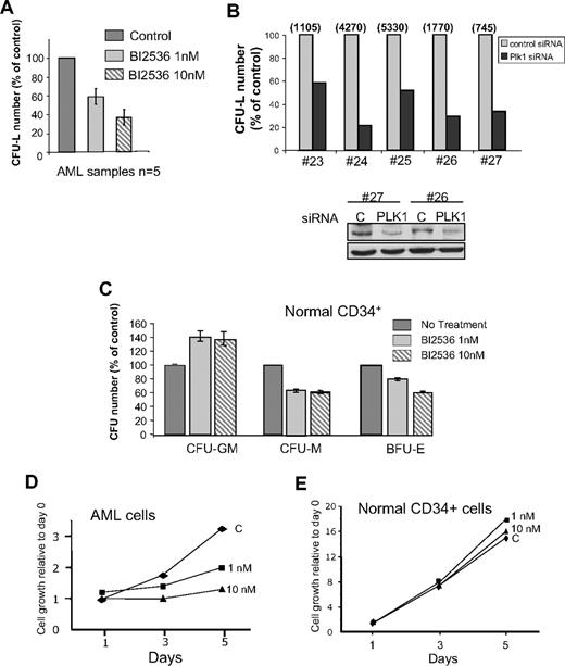 Figure 2. Effects of Plk1 inhibition on normal hematopoietic CD34+ progenitors and AML primary cells from patients. (A) Fresh AML cells were grown in clonogenic assays in the presence of increasing doses of BI2536. Results are presented as percentage of control and are mean ± SD of duplicates from 5 patients tested. (B) AML cells from patients were transfected with Plk1-specific or control siRNA, and grown in clonogenic assays as in panel A (top panel). Representative data showing the efficiency of PLK1 knockdown by Western blot are shown (bottom panel). Results are presented as percentage of control for each patient, and the absolute number of colonies for each control condition was indicated on the top of the figure. (C) Normal CD34+ progenitors were grown for 14 days in similar conditions as in (A), in the medium indicated in “Methods.” Results shown are mean ± SD of 2 independent experiments performed in duplicate. (D) Primary AML cells were grown in liquid cultures in the conditions described in “Methods,” and counted each day in the presence of trypan blue. The proliferation rate was compared in the presence of 1 nM and 10 nM, or in the absence of B12536. This experiment is representative of results obtained with 4 patients. (E) Same experiment as in panel C, but performed with primary normal CD34+ cells from healthy donors. This graph is representative of 2 experiments performed in duplicate.