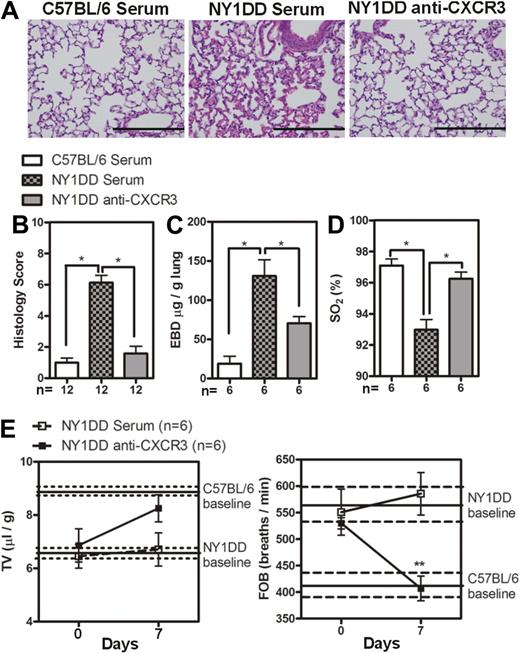 Figure 5. Anti-CXCR3 treatment decreases pulmonary injury in NY1DD mice. (A) Representative images of H&E-stained lungs from C57BL/6 or NY1DD mice treated with goat serum and NY1DD mice treated with goat anti-CXCR3. Scale bar represents 200 μm. (B) Histopathologic scores (0-8, see “Methods”) by analysis of H&E-stained mouse lungs. (C-D) Anti-CXCR3-treated NY1DD animals have decreased vascular permeability and increased arterial oxygen saturation compared with serum-treated NY1DD mice. (E) Anti-CXCR3-treated NY1DD mice have improved breathing (increased tidal volume and decreased frequency of breathing) compared with serum-treated NY1DD mice. Data were analyzed by one-way ANOVA with Neuman-Keuls posttesting. Breathing parameters were analyzed by 2-way ANOVA with Bonferroni posttesting. Histologic grading was analyzed with a nonparametric Kruskal-Wallis test with Dunn posttesting (*P < .05). EBD, Evans blue dye; SO2 indicates arterial oxygen saturation; FOB, frequency of breathing; and TV, tidal volume.