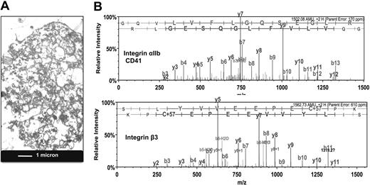 Figure 1. Presence of platelet proteins in MPs of EPC cultures. (A) Transmission electron microscopy. Image of MPs harvested from the conditioned medium of EPC cultures. (B) Proteomic analysis. Product ion spectra of doubly charged tryptic peptides identified as the platelet integrin αIIb (GQVLVFLGQSEGLR) and integrin β3 (SILYVVEEPECPK).