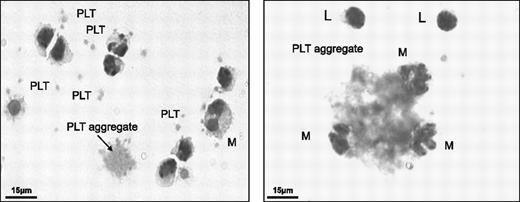 Figure 3. Platelet contamination of PBMNCs. PBMCs were fixed and stained using the Hema Gurr rapid staining set for hematology according to the manufacturer's instructions (VWR International). Platelets and platelet aggregates were present among washed PBMNCs. PLT denotes platelets; M, monocytes; and L, lymphocytes.