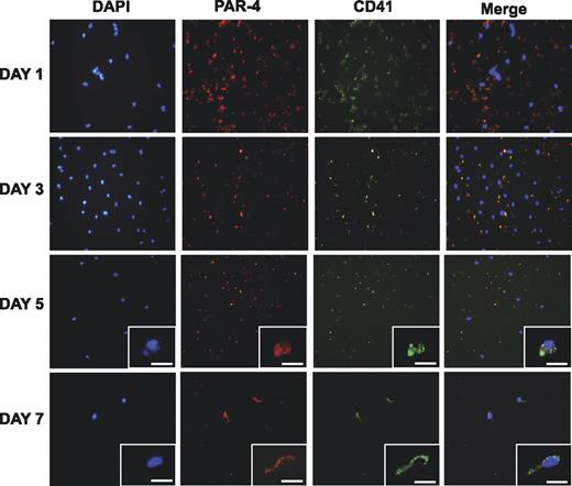 Figure 4. Cellular uptake of platelet MPs. Intact platelets stained positive for PAR-4 and integrin αIIb (CD41) among the PBMNCs counterstained with DAPI (day 1). Over time, the platelets disintegrated, but platelet proteins remained detectable in EPC cultures (day 3) and were taken up by the adherent cell population (day 5, inset). By day 7, most cells stained positive for platelet markers (insets: scale bar represents 25 μm).