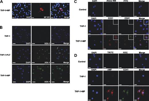 Figure 6. Platelet MPs and endothelial characteristics. (A) Platelet MPs were generated by activating platelets with thrombin, labeled with a fluorescence-conjugated lectin (MP D/R), and incubated with the monocytic THP-1 cell line. An uptake of labeled platelet MPs by THP-1 cells was observed within 1 to 2 hours. (B) THP-1 cells bound UEA-1 after coincubation with intact platelets or platelet MPs. PLT denotes platelets; arrows depict platelets among THP-1 cells. After incubation with platelet MPs for 2 days, THP-1 cells stained positive for CD31 (C) and VWF (D), but also for integrin αIIb (CD41) confirming that platelet MPs can be responsible for the markers used to prove the “endothelial” potential of EPCs. Scale bar represents 25 μm.