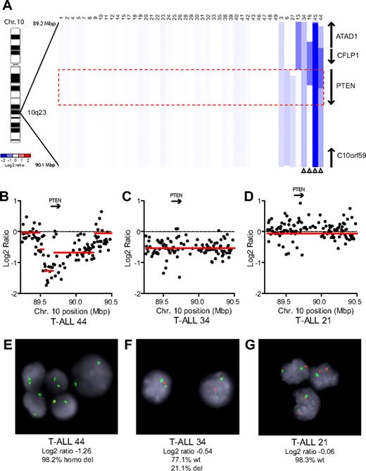 Figure 1. PTEN deletions in T-ALL. (A) Array CGH was performed with genomic DNA from diagnostic specimens collected from 47 children with T-ALL. The data are shown as a dChip plot of CGH segmented log2 copy number ratios at the PTEN locus. The red box denotes the location of the PTEN coding sequence. White arrowheads point to cases with segmented log2 copy number ratios of less than −0.5 involving the PTEN coding sequence. Two samples on which CGH was unsuccessful (T-ALL 36 and 37) were excluded from analysis. (B-D) Raw CGH data from representative patient samples. Red lines represent the segmented log2 copy number ratio shown in panel A. (E-G) FISH analysis of representative cases confirmed the deletions identified by CGH. Orange, PTEN probe; green, centromere 10 probe. Images were obtained with an Axio Imager A1 fluorescence microscope (Carl Zeiss) using a 100× Alpha Apochromatic Plan oil-immersion objective (Carl Zeiss), a JAI CV-M4+CL progressive scan camera (JAI Inc), and Genus acquisition software version 3.92 build 7 (Genetix USA). Note that the Genus cytogenetic image acquisition software applies an automated “thresholding” algorithm that sets a signal intensity threshold below which any signal is considered background and thus excluded from the final composite image. During image acquisition, all images generated by the software were compared to the view from the microscope to confirm that they were fully representative. (B,E) Homozygous deletions had log2 ratios of −1.26 (case 44) and −4.11 (case 45). Cells were available for FISH on case 44 and clearly showed homozygous loss of PTEN. (C,F) The CGH detection of a heterozygous deletion in case 34 (log2 ratio, −0.54) correlated with the detection of PTEN deletion by FISH on 1 allele in 21% of the cells examined. (D,G) Case 21 retained both PTEN alleles intact by FISH and CGH.