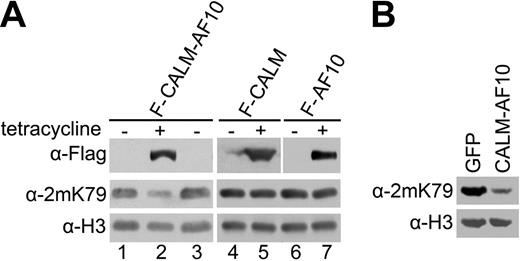 Figure 2. CALM-AF10 fusion protein causes H3-K79 hypomethylation. (A) H3K79 methylation in human T-REx-293 cell lines stably transfected with the indicated expression constructs. The cells were not induced (−) or induced with tetracycline for 48 hours (+), or analyzed after 72-hour further culturing after the withdrawal of tetracycline (lane 3). (B) H3K79 methylation in blast cells from leukemic mice with retroviral expression of CALM-AF10. Whole-cell extracts were prepared from leukemic cells with CALM-AF10 expression (right lane) and bone marrow transduced with the retroviral vector only expressing GFP (left lane), and were probed with indicated histone antibodies. All the cells were from GFP-positive sorting by FACS.