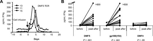 Figure 5. Patients treated with the highly reactive DMF5 or gp100(154), but not DMF4 TCR, had increased serum IFN-γ levels after treatment. Patient IFN-γ serum levels were measured daily before, during, and after cell infusion by ELISA. (A) Serum IFN-γ levels increased from baseline to a peak at 3 to 6 days after cell infusion (3 representative DMF5 patients are shown). (B) Peak IFN-γ levels in serum after treatment for patients treated with DMF5, gp100(154), and DMF4 TCR-transduced cells. Only patients treated with the highly reactive DMF5 or gp100(154) TCR demonstrated increased IFN-γ in serum (P = .001 and P < .001, respectively, compared with P = .09 for DMF4 TCR).