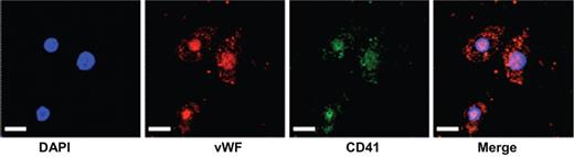 Cultured monocytic cell line stained with DAPI for nuclear detection, von Willebrand factor (VWF), CD41 (glycoprotein IIb), and merged image, demonstrating the uptake of platelet-derived MPs by the adherant cells. Scale bar 25 μm. See the complete figure in the article beginning on page 723.