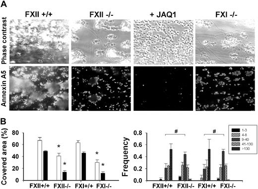 Figure 6. Deficiency in FXII or FXI impairs collagen-dependent thrombus and platelet procoagulant activity. Blood from FXII−/− or FXI−/− mice or corresponding wild types was flowed over collagen under coagulant condition for 4 minutes (Figure 5). Blood was pretreated with JAQ1 mAb (40 μg/mL), as indicated. Thrombi were poststained with OG488-annexin A5. (A) Representative phase-contrast and fluorescent images (175 × 225 μm). (B left panel) Surface area covered by thrombi (□) and annexin A5 fluorescence (■). (Right panel) Frequency distribution of small and large platelet thrombi (estimated number of platelets per feature indicated in box). Mean ± SEM; n = 5-7; *P < .05 vs corresponding wild type; #P < .05, χ2 test.