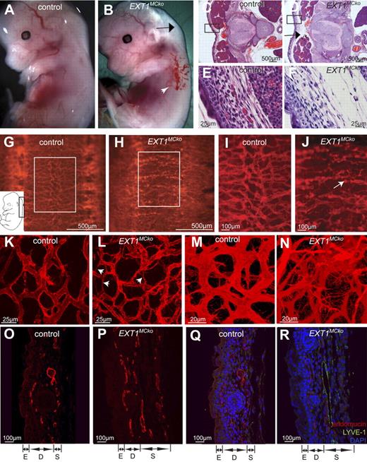 Figure 3. Abnormal vessel morphology and patterning defects in EXT1MCko. Macroscopic analysis of E13.5 control (A) and EXT1MCKO embryos revealed edema (, B) and hemorrhages (white arrowhead, B) in the skin; n > 3. Transverse sections demonstrate increased interstitial space (D, ) and loose connective tissue in the epidermis of EXT1MCko (F) compared with the control littermate (C,E); n = 2. Endomucin staining (G-N, red) of E13.5 mutant embryos revealed abnormal patterning of the superficial vessels at the back along the spinal cord (G-H). (I-J) Higher-magnification images of the boxed area in panels G and H. The skin vasculature of the control littermates is uniform in its size and diameter (K). In contrast, EXT1MCko display irregular-shaped, tortuous vessels with fluctuation in their diameter (arrowheads, L). EXT1MCko exhibit excessive filopodia extension (N), indicating aberrant sprouting processes, which are reflected in embryonic skin sections showing a widespread network of blood vessels through the entire depth of the skin (P). On the contrary, the skin vasculature in control embryos is restricted to a two-dimensional network (M,O); n > 5. Visualization of lymphatic vessels (LYVE-1, green) revealed an increase in lymphatic vessels in EXT1MCko embryonic skin (R) compared with control littermates (Q); however, colabeling with endomucin (red) showed separation of lymphatic and blood vessels and no defects in lymphangiogenesis. E indicates epidermis; D, dermis; S, subcutis. n = 2.
