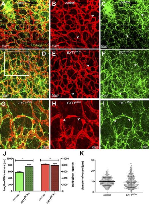 Figure 4. MC HS is important for stability and diameter control of vessels in the skin. Endomucin (red) and collagen IV (green) staining of embryonic skin revealed regressing blood vessel in EXT1MCko embryos compared with control littermates (A-I). White arrowheads represent regressing vessels lacking EC marker endomucin but positively stain for BM component CIV. Higher magnification images (G-I) of the boxed area in panel D show disconnected ECs that lack proper formation of lumen (arrowheads). Quantification for CIV-positive and endomucin-negative vessels confirmed significant increase in regressing blood vessels of EXT1MCko (J), whereas the density of the vascular network in the skin is unaffected (J, red bars). (J) n > 15 images/embryo; 2 embryos/group. Measurement of vessel diameter reveals a significant increase in diameter variability, whereas the mean diameter is identical between control and mutant samples. This conspicuous variation in vessel diameter was consistently observed in all mutant samples; n > 5. (K) Measurement of 650 vessel profiles (n > 15 images/embryo), reflecting the variability in vessel diameter in EXT1MCko embryos; n = 2. ***F < 0.0001 (F test, variance of SD). ns indicates not significant.