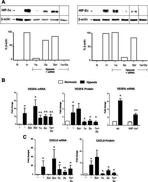 Figure 1. Role of HIF-1α and -2α in the hypoxic induction of VEGFA and CXCL8: insights from siRNA knockdown studies and use of macrophages bearing a deletion in the HIF-1α gene. (A) Immunoblots of HIF-1α or HIF-2 α in MDM lysates after their exposure to normoxia (20.9% O2; N) or hypoxia (0.1% O2; H) for 18 hours, or hypoxia for 18 hours after exposure to siRNA for HIF-1α (1α), HIF-2 (2α), both HIFs-1α and 2α together (1α + 2α), or a scrambled control (Scr). Loading controls were β-actin. Vertical lines have been inserted to indicate repositioned lanes from the same gel. Below each gel picture is the densitometric analysis of HIF expression relative to its β-actin loading control. (B-C) Effects of HIF-1α and -2α knockdown on the hypoxic induction of VEGFA (B) and CXCL8 (IL-8; C) mRNA and protein. In the case of VEGF, gene expression was also assayed in normoxic and hypoxic BMDMs from mice bearing a myeloid cell-specific knockout of the HIF-1 α gene (HIF-1α−/−) in vitro by quantitative RT-PCR (B right panel). It was not possible to do this for CXCL8, as this gene is not expressed in mice. Pooled data from 6 replicate experiments are shown. *P < .05 compared with corresponding normoxic group. ∧P < .05 compared with the scr siRNA/hypoxia group. +P < .05 compared with macrophages from wild-type mice exposed to hypoxia.