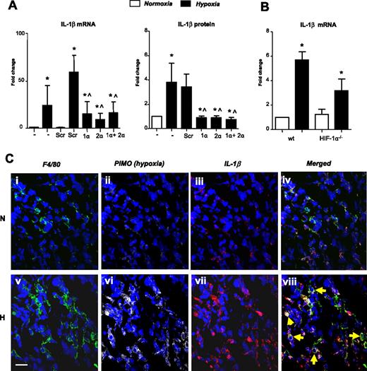 Figure 2. Hypoxic up-regulation of IL-1β by human MDMs in vitro and by TAMs in hypoxic areas of murine mammary tumors: role of HIF-1 and -2. (A) IL-1β mRNA levels and protein release by human MDMs after their exposure to normoxia (20.9% O2; N) or hypoxia (0.1% O2; H) for 18 hours, or hypoxia for 18 hours after exposure to siRNA for HIF-1 α (1 α), HIF-2α (2 α), both HIFs-1α and -2α together (1α + 2α), or a scrambled control (Scr). (B) Hypoxic induction of IL-1β mRNA by BMDMs from wild-type mice and mice bearing a myeloid cell-specific knockout of the HIF-1 α gene. (C) Up-regulated expression of IL-1β by F4/80+ macrophages in pimonodazole-stained (ie, hypoxic; H) compared with pimonodazole-unstained (ie, normoxic; N) areas of murine mammary (4T1) tumors (yellow arrows on the merged H image). Pooled data from 3 replicate experiments are shown. *P < .05 compared with corresponding normoxic group. ∧P < .05 compared with the Scr siRNA/hypoxia group. +P < .05 compared with macrophages from wild-type mice exposed to hypoxia.