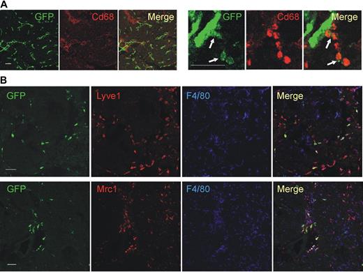 Figure 2. Confocal immunofluorescence analysis of mouse tumors identifies a distinguishing TEM signature. (A) N202 mammary tumors (n = 5) grown subcutaneously in Tie2-GFP transgenic mice and analyzed for GFP (green) and Cd68 (red) expression. Confocal planes are shown individually and after merging (merge). The left panels show GFP+ blood vessels and abundant Cd68+ macrophages; scale bar represents 120 μm. High-magnification photos (right panels) show perivascular Tie2-GFP+Cd68+ TEMs (arrows); scale bar represents 60 μm. For each tumor, at least 3 sections were analyzed. (B) Mammary tumors spontaneously arising in MMTV-PyMT transgenic mice (n = 4) previously transplanted with Tie2-GFP BM cells and analyzed for GFP (green), Lyve1 or Mrc1 (red), and F4/80 (blue) expression. Abundant F4/80+ macrophages are evenly distributed within the tumor mass, whereas GFP+Lyve1+ or GFP+Mrc1+ TEMs cells are mainly found in stromal septa surrounding tumor cell nests. Virtually all the Tie2-GFP+ cells express Lyve1 and Mrc1. Note that some of the Tie2-GFP− Lyve1+ or Mrc1+ cells may represent host-derived, nontransgenic TEMs. Scale bar represents 60 μm. For each tumor, at least 10 sections were analyzed for each marker.