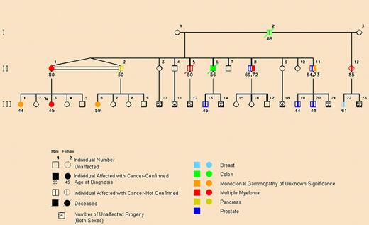 Pedigree showing family members with multiple myeloma or monoclonal gammopathy of undetermined significance (MGUS) in a pattern consistent with autosomal dominant transmission. The pedigree shows a decrease in the age of onset of prostate cancer, MGUS, and multiple myeloma from generation II to generation III. The arrow indicates the proband. The double horizontal line between family members II-1 and II-2 indicates that they are identical twins. Reprinted from Lynch et al2 with permission.