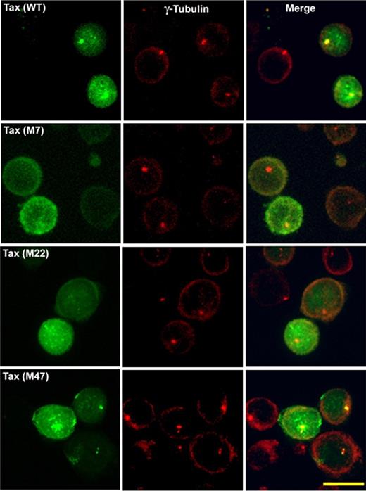 Figure 3. Intracellular distribution of wild-type and mutants of HTLV-1–Tax protein in transiently transfected Jurkat cells. Jurkat cells were transfected with GFP-Tax or GFP-Tax mutants M7, M22, or M47. Jurkat cells were fixed with cold methanol (6 hours after transfection) and permeabilized. The MTOC was stained with polyclonal anti–γ-tubulin antibody (red). Each panel shows projected images (x, z) corresponding to GFP-Tax or GFP-Tax mutant (green), MTOC (red), and the superposition of the 2 colors (merge). Scale bar represents 10 μm.