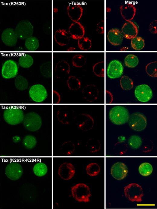 Figure 4. Intracellular distribution of HTLV-1–Tax protein ubiquitin mutants in transiently transfected Jurkat cells. Jurkat cells are transfected with GFP-Tax or GFP-Tax-K263R, GFP-Tax-K280R, GFP-Tax-K284R, or GFP-Tax-K263R-K284R. The cells are fixed with cold methanol (6 hours after transfection) and permeabilized. The MTOC is stained with polyclonal antibody anti–γ-tubulin (red). Each panel shows projected images (x, z) corresponding to GFP-Tax or GFP-Tax mutant (green), MTOC (red), and the superposition of the 2 colors (merge). Scale bar represents 10 μm.