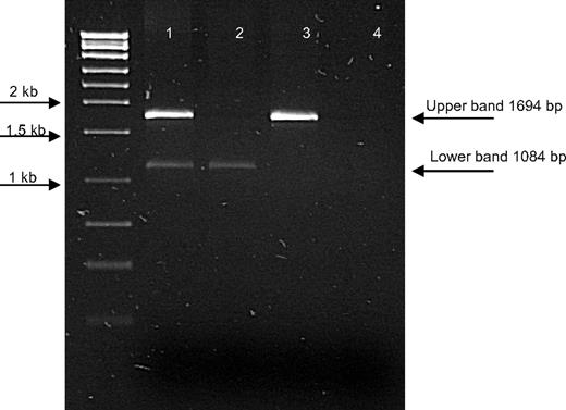 Figure 1. Gel image to illustrate the deletion of exons 4 and 5 at the DNA level. The top band (1694 bp) represents the wild-type PCR product, which amplifies across exons 4 and 5; bottom band (1084 bp), the PCR product designed to amplify across the deletion breakpoint. Lane 1 indicates a patient heterozygous for the deletion; lane 2, a patient homozygous for the deletion; lane 3, a wild-type control; and lane 4, a negative control.