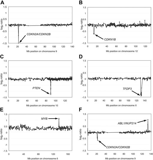 Figure 2. Aberrations of single chromosomes affecting genes in leukemogenic pathways. Representative array-CGH profiles of single chromosomes from T-ALL with homozygous deletions of CDKN2A/CDKN2B (A), heterozygous deletion of CDKN1B (B), homozygous deletions of PTEN (C) or TFDP3 (D), amplification of MYB (E), as well as an amplification of ABL1/NUP214 and a heterozygous deletion of CDKN2A/CDKN2B (F). Aberrations are indicated by arrows. All data points are shown as log2-ratios comparing T-ALL DNA with a pool of normal blood DNA from 10 donors. Clones are plotted in chromosome order.