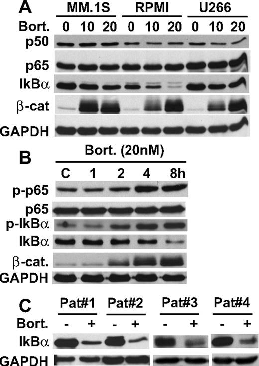 Figure 1. Bortezomib down-regulates IκBα expression. (A) MM.1S, RPMI 8226, and U266 cells were cultured with bortezomib (10 nM and 20 nM) for 8 hours. (B) RPMI 8226 cells were cultured with bortezomib (20 nM) for the indicated time periods. (C) Primary tumor cells from MM patients were cultured with bortezomib (20 nM) for 8 hours. Whole-cell lysates (A-C) were immunoblotted with indicated Abs.