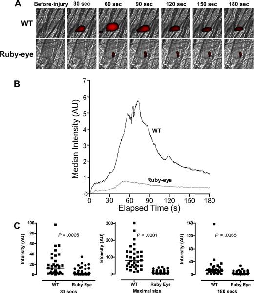 Figure 3. Platelet accumulation in ruby-eye mice after laser-induced injury of cremaster arterioles. (A) Platelet accumulation was imaged at the indicated time intervals, after injury, in both wild-type (WT) and ruby-eye mice. (B) Median integrated platelet fluorescence intensity was recorded at each second for 180 seconds after laser injury in ruby-eye mice. (C) At 30 seconds, median platelet accumulation in ruby-eye mice was 22% of WT (P = .001). Maximal thrombus size in ruby-eye mice was decreased compared with WT mice (12% of WT; P = .001). By 180 seconds, median platelet accumulation in ruby-eye mice was 31% of WT mice (P = .007).