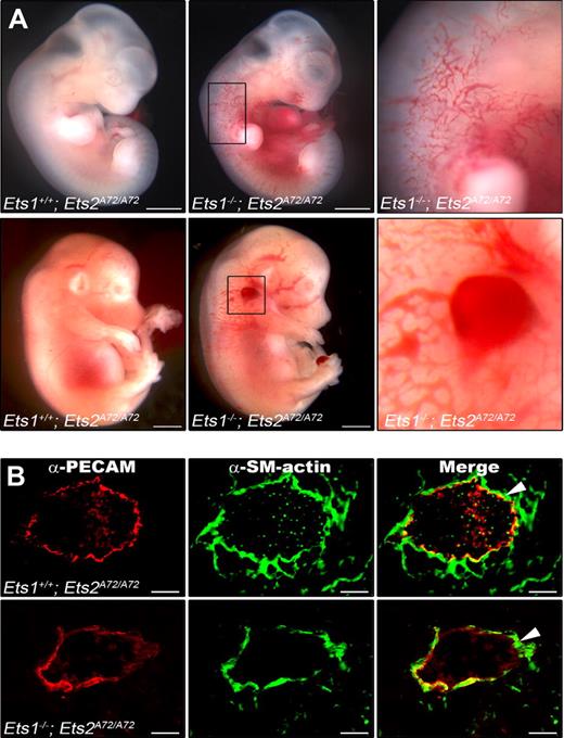 Figure 1. Ets1−/−;Ets2A72/A72 mutant embryos have edema and hemorrhage, but blood vessel structure is unaffected. (A) E11.5 (top) and E14.5 (bottom) embryos; control embryo is at the left, mutant embryo is at the right. Boxed areas are enlarged to show region of edema at E11.5 or hemorrhage at E14.5. Bars, 0.5 mm. (B) Cryosections of control (top) and Ets1−/−;Ets2 A72/A72 (bottom) embryos were stained with anti–PECAM antibody (green) and anti–smooth muscle α-actin antibody (red). Representative data for E13.5 embryo are shown; a total of 4 embryos were analyzed. Bars, 50 μm