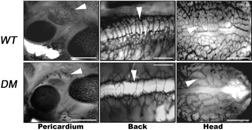 Figure 2. Ets1−/−;Ets2A72/A72 embryos have defects in vessel branching and reduced vascular complexity. E10.5 mouse embryos were analyzed by immunohistochemistry with anti–PECAM antibody in whole mount. Controls are in top row (WT), and Ets1−/−;Ets2A72/A72 embryos are in lower row (DM). Arrowheads highlight examples of vessel branching in control embryos that are absent in the double-mutant embryos. Bars, 0.25 mm.