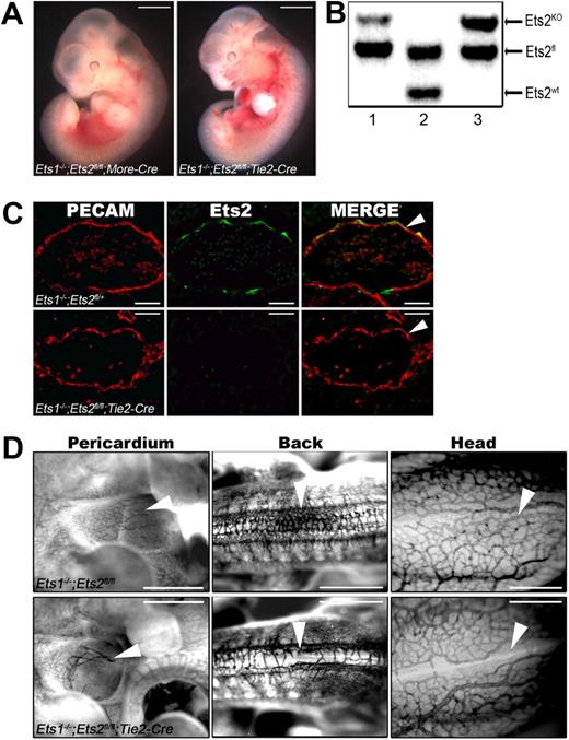 Figure 4. Tie-2-Cre;Ets1−/−;Ets2fl/fl embryos have obvious defects in angiogenesis. (A) MORE;Ets1−/−;Ets2fl/fl (left) and Tie2-Cre;Ets1−/−;Ets2fl/fl (right) E11.5 embryos with edema and hemorrhage. Bars, 0.5 mm. (B) PCR products from DNA extracted from yolk sac of E11.5 Tie2-Cre;Ets1−/−;Ets2fl/fl (lane 1), Ets2fl/+ (lane 2), or Ets2fl/KO (lane 3) mice. (C) PECAM (red) and Ets2 (green) antibody staining of cryosections from E11.5 embryos of genotype Ets1−/−;Ets2fl/fl (top panels) or Tie2-Cre;Ets1−/−;Ets2fl/fl (bottom panels). The third panel is the merged image of PECAM and Ets2 staining. Bars, 50 μm (D) PECAM antibody staining in whole mount of Tie2-Cre;Ets1−/−;Ets2fl/fl embryos and Ets1−/−;Ets2fl/fl controls, as indicated. Representative data are shown, including pericardium (E11.5, first left panel set), back (E10.5, second middle panel set), and head (E10.5, third right panel set). Arrowheads highlight examples of vessel branching in control embryos that are absent and/or abnormal in the double-mutant embryos. Bars, 0.25 mm.