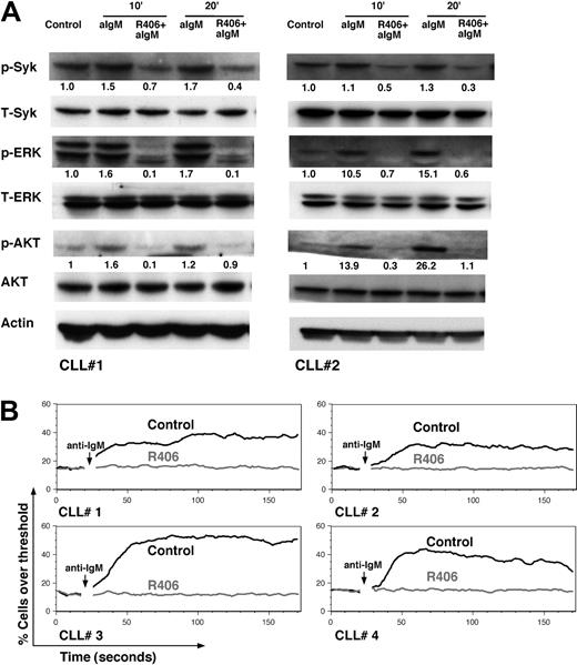 Figure 8. R406 inhibits BCR signaling in CLL cells. (A) Displayed are immunoblots from CLL cells from 2 representative patients who were either unstimulated (control), or stimulated for 10 or 20 minutes with anti-IgM in the presence or absence of R406. These different conditions are displayed above the immunoblots. At the indicated time points, the cells were lysed and probed with mAbs to the antigens that are displayed on the left side. “P” indicates immunoblotting for the active, phosphorylated form, whereas “T” represents the nonphosphorylated, total amount of the respective proteins. We found that constitutive and anti-IgM–induced Syk activation, p44/42 mitogen-activated protein kinase (ERK), and AKT activation were inhibited by R406. Relative protein levels were determined by densitometry, normalized to the corresponding control, and are displayed below each of the phosphoprotein bands. (B) Calcium mobilization is another signaling response typically induced in B cells after BCR triggering. In this figure, CLL cells were labeled with the fluorescent calcium-indicator Fluo3-AM, and preincubated with or without R406. Then the CLL cells were stimulated with anti-IgM, and the fluorescence intensity was recorded over time. The lines represent the changes in fluorescence intensity (on the vertical axis) over time (horizontal axis) for control CLL cells (black lines) or cells preincubated with R406 (gray lines). Displayed is the anti-IgM–induced calcium mobilization in 4 different patients (labeled CLL#1-4), with a detectable calcium mobilization in the controls, and an abrogated calcium mobilization in R406-pretreated CLL cells.
