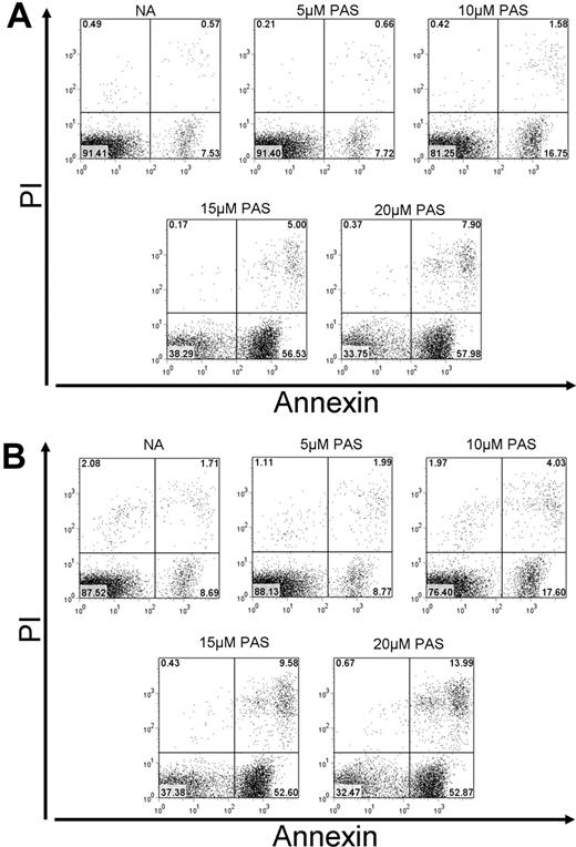 Figure 2. Annexin V/PI analysis of CLL cells treated with PAS. Cells from patient AS31 with functional p53 (A) or patient AS32 with more than 97% p53 deletion (B) were treated with 0, 5, 10, 15, and 20 μM PAS for 24 hours. Apoptosis was quantified by annexin V/PI FACScan analysis. Values in each quandrant represent the percentage of gated cells in each quarter.