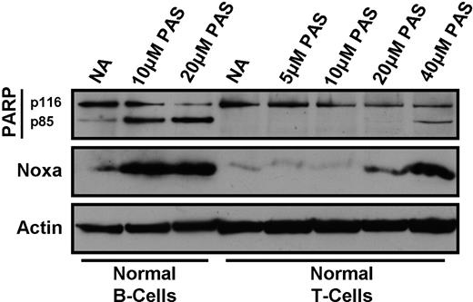 Figure 7. Effect of PAS on normal B and T cells. Normal B and T cells were purified by negative selection and treated with the indicated concentrations of PAS for 18 hours. Lysates were analyzed by Western blotting.